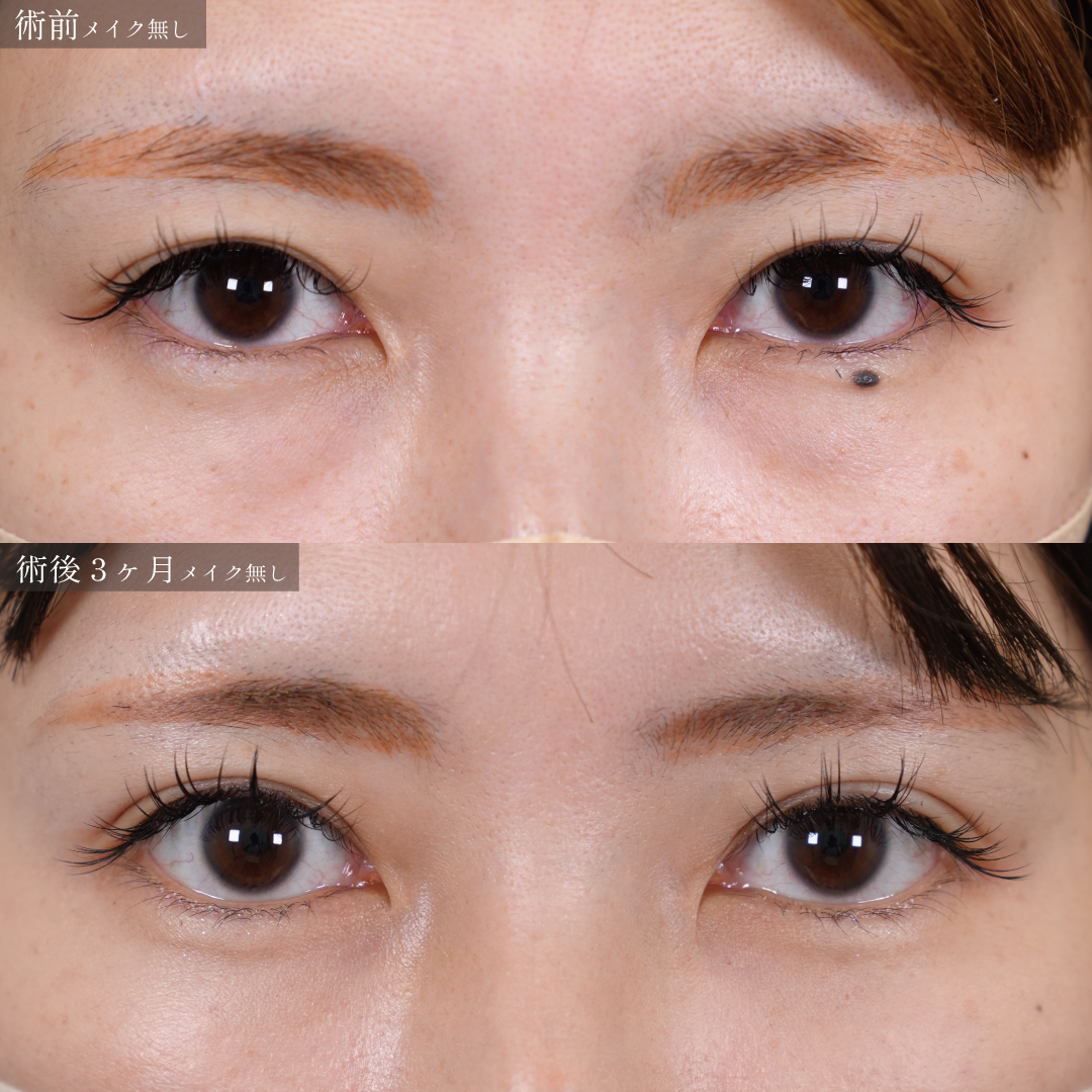 23231543a42eb93f6355a612f24a51